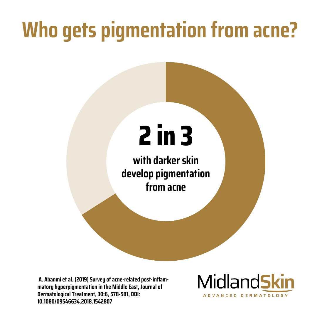 Two out of three people, among those with darker skin types, develop pigmentation from acne